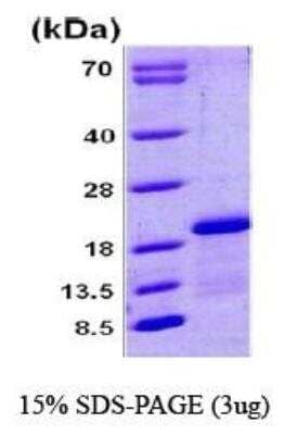 SDS-Page: Recombinant Human Complexin-1 Protein [NBC1-18349] - Complexin 1, 17.1 kDa (154 aa), confirmed by MALDI-TOF with a purity of 90% by SDS - PAGE