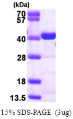 SDS-Page: Recombinant Human CrkL Protein [NBP1-50941] - 15 % SDS-PAGE (3ug)