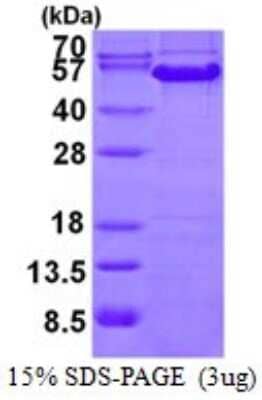 SDS-PAGE Recombinant Human Cyclin A2 His Protein