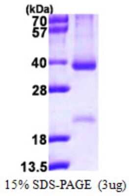 SDS-Page: Recombinant Human Cyclin D2 Protein [NBP1-78841] - 15% SDS-PAGE (3ug)