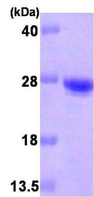 SDS-Page: Recombinant Human Cysteine Dioxygenase Type 1 Protein [NBP1-30241] - Cysteine Dioxygenase Type 1 Protein [NBP1-30241] - 15% SDS-PAGE (3ug)