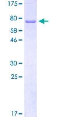 SDS-Page: Recombinant Human Cytokeratin 12 Protein [H00003859-P01-10ug] - Qualitative analysis.