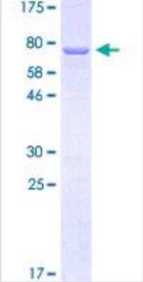 SDS-Page: Recombinant Human Cytokeratin 12 Protein [H00003859-P01] - Recombinant Human Cytokeratin 12 Protein [H00003859-P01-10ug] - Qualitative analysis.