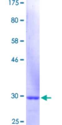 SDS-Page: Recombinant Human Cytokeratin 3 Protein [H00003850-Q01] - 12.5% SDS-PAGE Stained with Coomassie Blue.