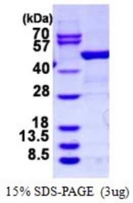 SDS-Page: Recombinant Human D4-GDI/RhoGDI2 Protein [NBP1-99054] - 15% SDS-PAGE (3ug)