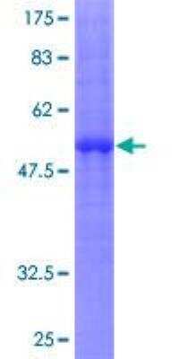 SDS-Page: Recombinant Human DCIR/CLEC4A Protein [H00050856-P01] - 12.5% SDS-PAGE Stained with Coomassie Blue.