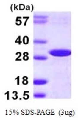 SDS-PAGE Recombinant Human DCUN1D2 His Protein