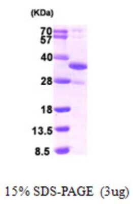 SDS-PAGE Recombinant Human DDIT4 His Protein