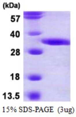 SDS-Page: Recombinant Human DECR2 Protein [NBP1-78829] - 15% SDS-PAGE (3ug)