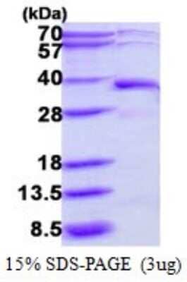 SDS-Page: Recombinant Human DERA Protein [NBP1-78809] - 15% SDS-PAGE (3ug)
