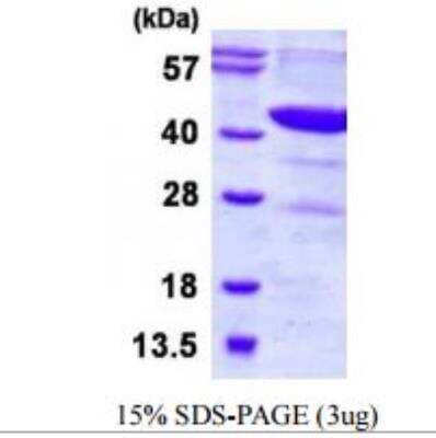 SDS-Page: Recombinant Human DHODH Protein [NBP1-98916]