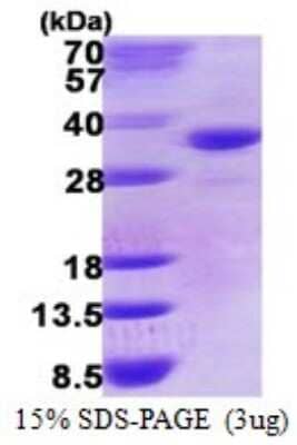 SDS-Page: Recombinant Human DHRS9 Protein [NBP1-78842] - 15% SDS-PAGE (3ug)