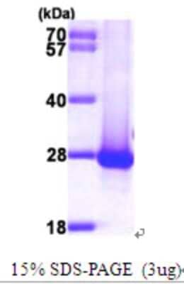 SDS-Page: Recombinant Human DIRAS1 Protein [NBP1-48597] - 15 % SDS-PAGE (3ug)