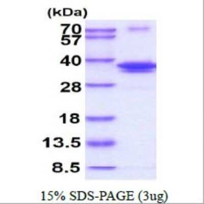 SDS-Page: Recombinant Human DNA Polymerase lambda Protein [NBP1-72496] - 15% SDS-PAGE (3ug)