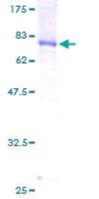 SDS-Page: Recombinant Human DNAJA2 Protein [H00010294-P01] - 12.5% SDS-PAGE Stained with Coomassie Blue.