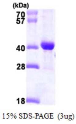 SDS-PAGE Recombinant Human DNAJB2 His Protein