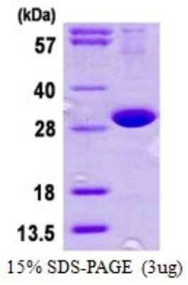 SDS-Page: Recombinant Human DNAJB8 Protein [NBP1-72504] - 15% SDS-PAGE (3ug)