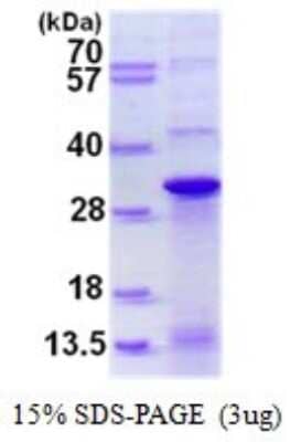 SDS-PAGE Recombinant Human DNAJC12 His Protein