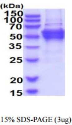 SDS-PAGE Recombinant Human DPH2 His Protein