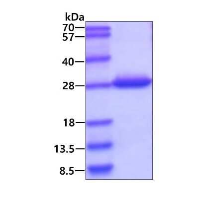 SDS-PAGE Recombinant Human DTYMK His Protein