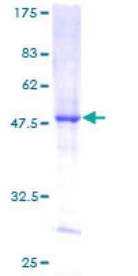 SDS-PAGE Recombinant Human DUSP14 GST (N-Term) Protein