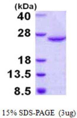 SDS-Page: Recombinant Human DUSP18 Protein [NBP1-99084] - 3ug by SDS-PAGE under reducing condition and visualized by coomassie blue stain