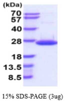 SDS-PAGE Recombinant Human DUSP18 His Protein