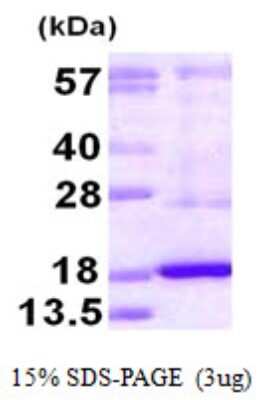 SDS-PAGE Recombinant Human DUSP19 His Protein