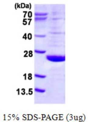 SDS-PAGE Recombinant Human DUSP21 His Protein