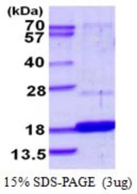 SDS-PAGE Recombinant Human DUSP23 His Protein
