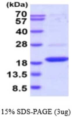 SDS-PAGE Recombinant Human DUSP23 His Protein