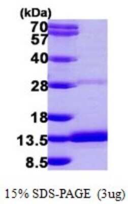 SDS-Page: Recombinant Human DYNLRB2 Protein [NBP1-78800] - 15% SDS-PAGE (3ug)