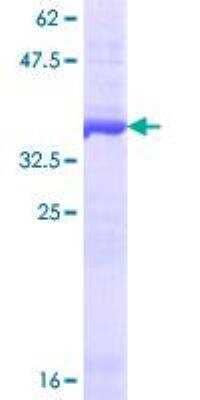 SDS-Page: Recombinant Human Drosha Protein [H00029102-Q01] - 12.5% SDS-PAGE Stained with Coomassie Blue.