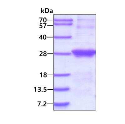 SDS-Page: Recombinant Human Dynactin 6 His Protein [NBP2-51843] - 3ug by SDS-PAGE under reducing condition and visualized by coomassie blue stain.