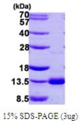 SDS-Page: Recombinant Human Dynein light chain 4 Protein [NBP1-72311] - 15% SDS-PAGE (3ug)