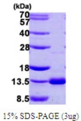 SDS-Page: Recombinant Human Dynein light chain 4 Protein [NBP1-72311] - 15% SDS-PAGE (3ug)