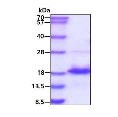 SDS-Page: Recombinant Human EAF1 Protein [NBP2-51550] - 3ug by SDS-PAGE under reducing condition and visualized by coomassie blue stain.