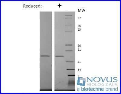 SDS-PAGE Recombinant Human EBI3 Protein