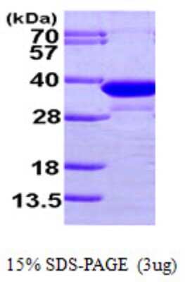 SDS-Page: Recombinant Human ECH1 Protein [NBP1-48389] - 15 % SDS-PAGE (3ug)