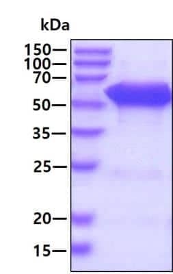 SDS-PAGE Recombinant Human EED His Protein