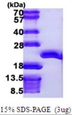 SDS-Page: Recombinant Human EEF1E1 Protein [NBP1-51088] - 15 % SDS-PAGE (3ug)