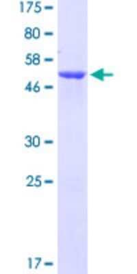 SDS-Page: Recombinant Human EFHD2 Protein [H00079180-P01] - 12.5% SDS-PAGE Stained with Coomassie Blue.