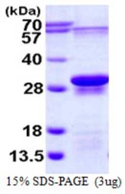 SDS-Page: Recombinant Human EIF3J Protein [NBP1-72511] - 15% SDS-PAGE (3ug)