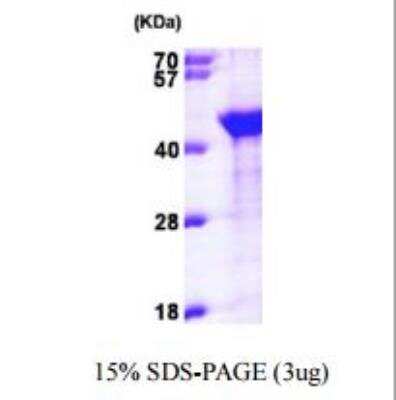 SDS-Page: Recombinant Human EMAP-II/AIMP1 Protein [NBP1-50936]