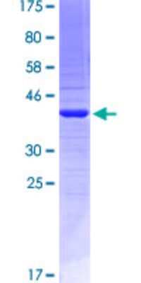 SDS-PAGE Recombinant Human EMILIN2 GST (N-Term) Protein