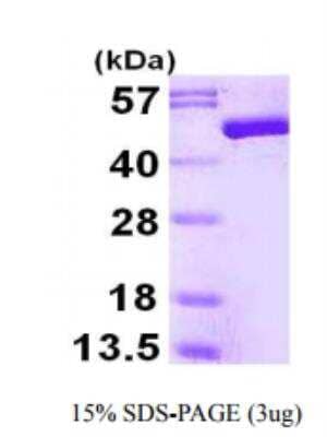 Recombinant Human ENO3 Protein [NBP1-72501]