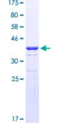 SDS-Page: Recombinant Human EOMES Protein [H00008320-Q03] - 12.5% SDS-PAGE Stained with Coomassie Blue.