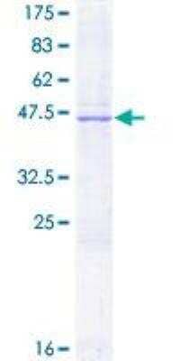 SDS-Page: Recombinant Human EPCR Protein [H00010544-P01] - 12.5% SDS-PAGE Stained with Coomassie Blue.