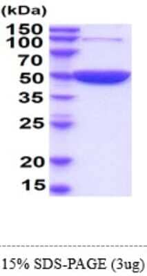 SDS-Page: Recombinant Mouse Enolase 1 Protein [NBP2-61192] - 15 % SDS-PAGE (3ug)