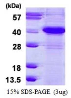 SDS-Page: Recombinant Human ERCC1 Protein [NBP1-98981] - 15% SDS-PAGE (3ug)